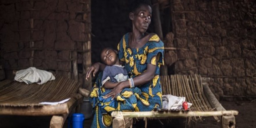 Kongo'da kolera dehşeti: 871 ölü 